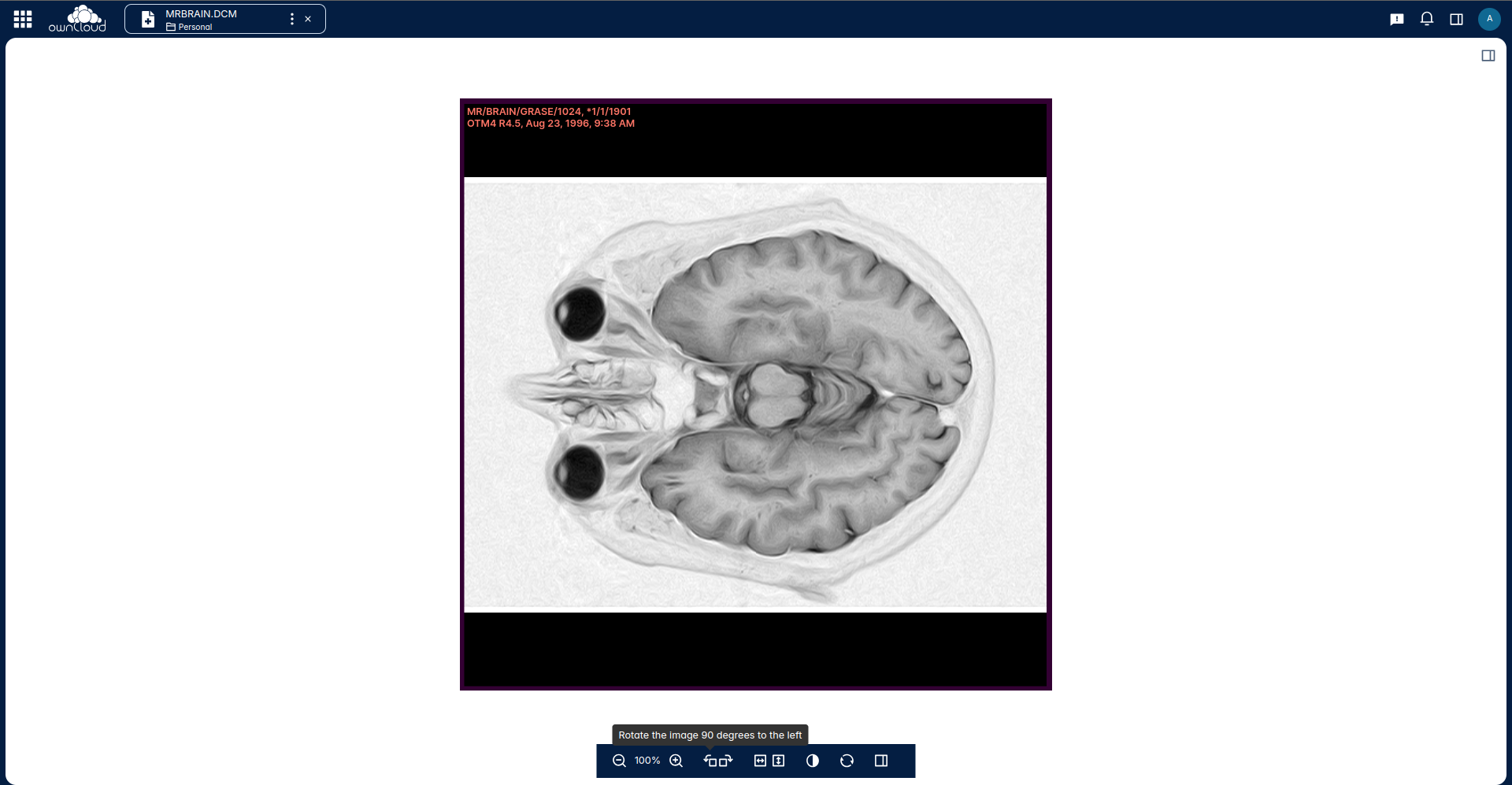 The extension allows to zoom, rotate and flip the preview of the DICOM image.