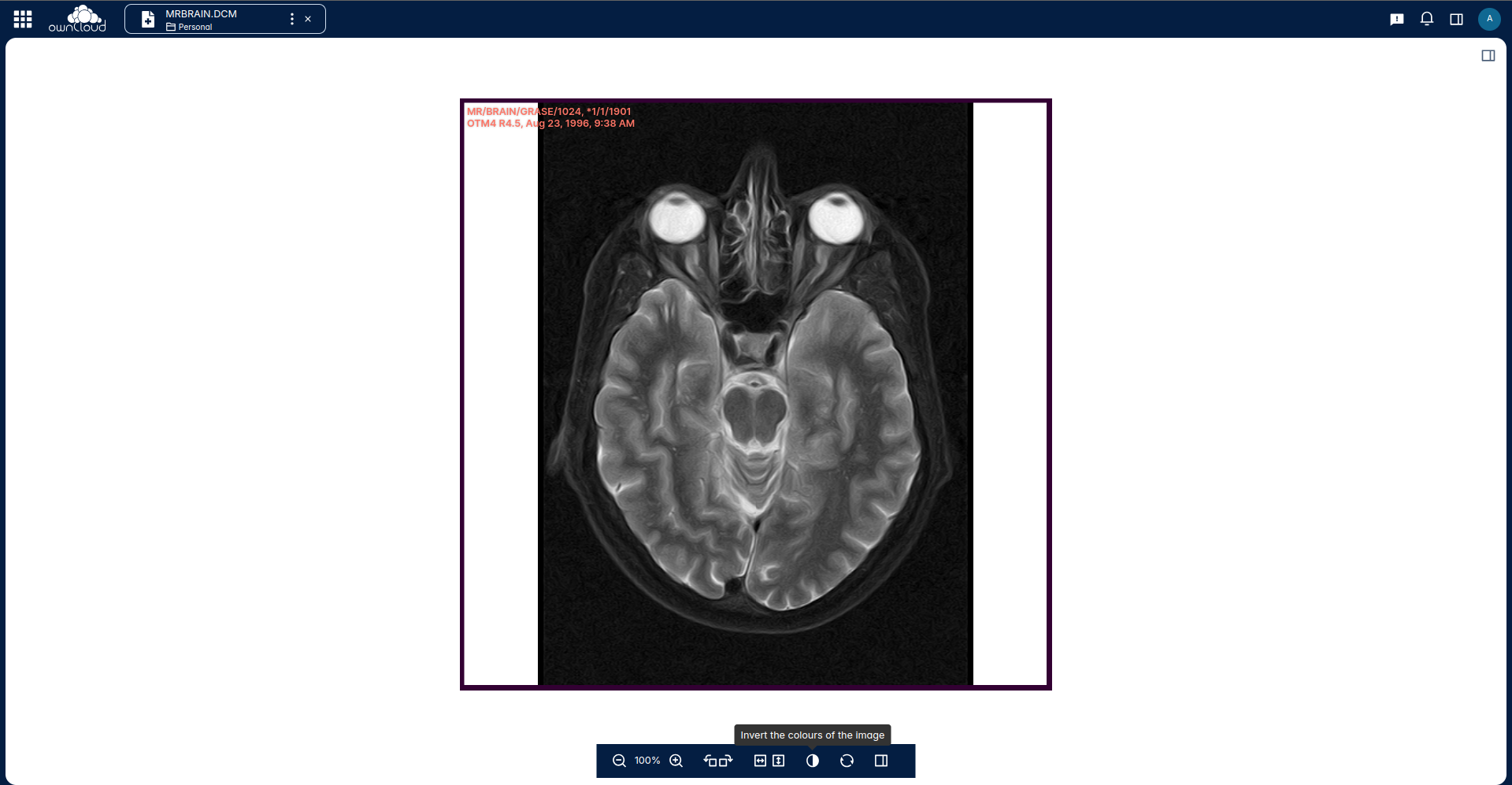 Inverting the colors of the preview of the DICOM image is also supported.